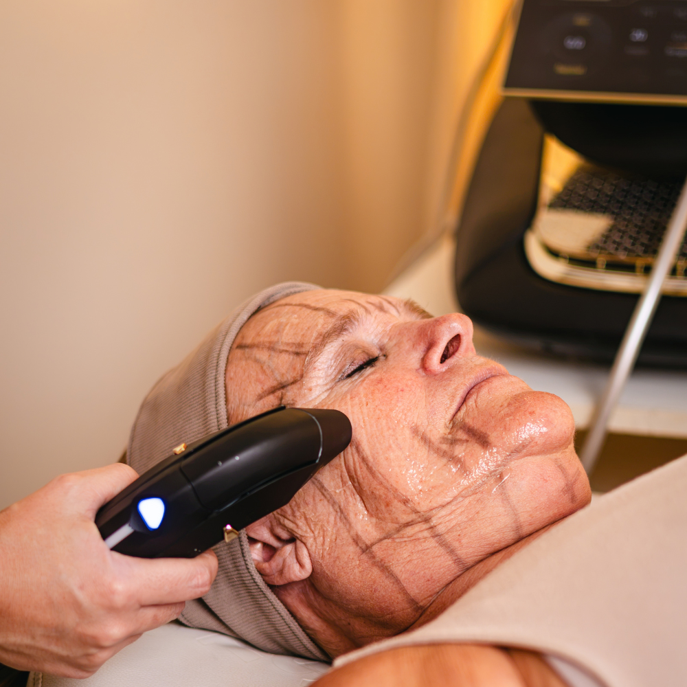 HIFU Facial