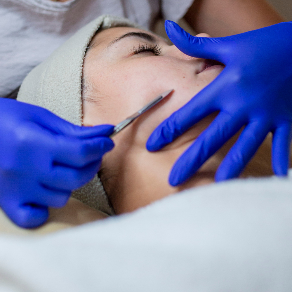 DERMAPLANING + LIMPIEZA FACIAL, RENOVACION CELULAR, SPA CALMA, VILLA MARIA