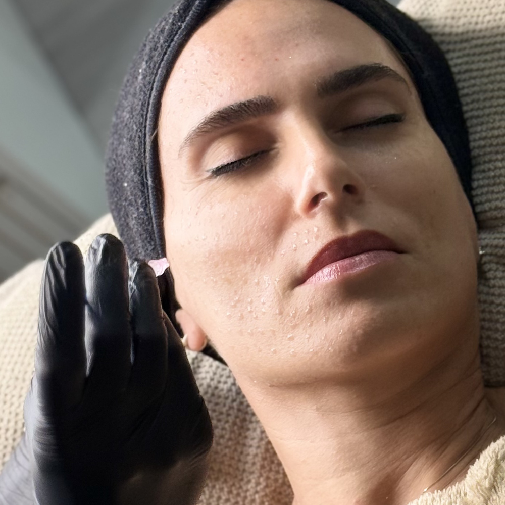 PDRN + Mesoterapia + Dermapen